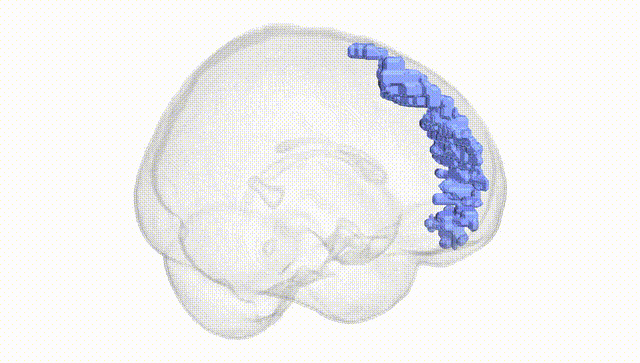 Full Brain White