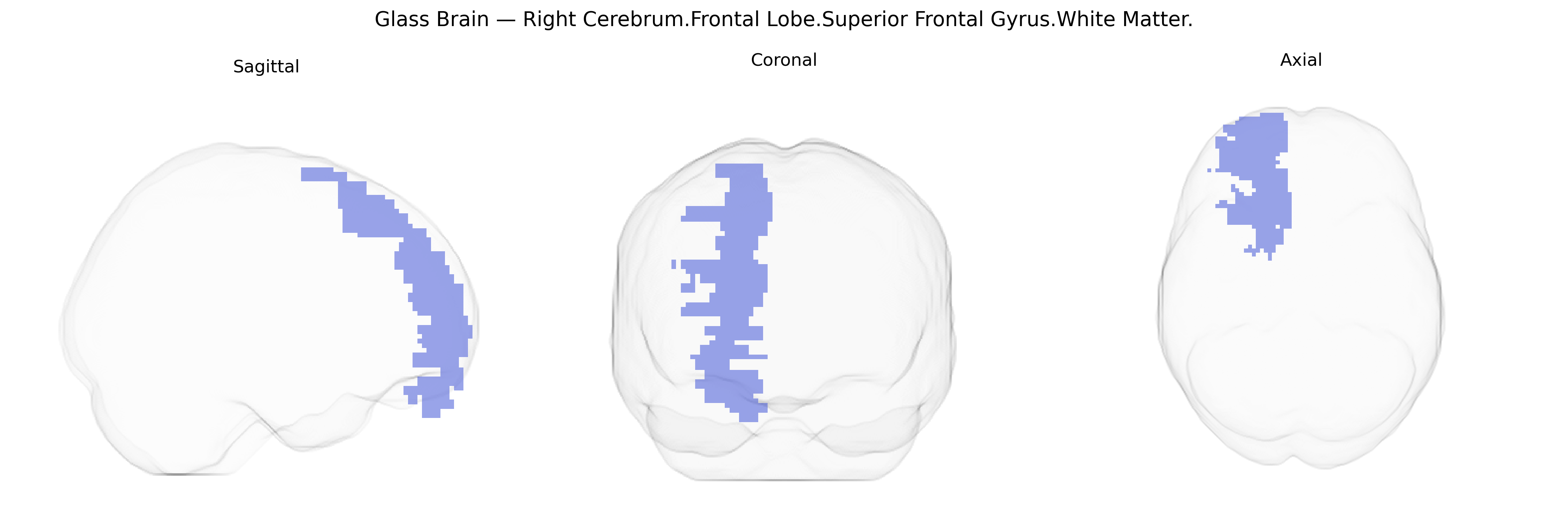 Triplanar Ghost Brain