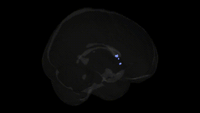 Full Brain Black