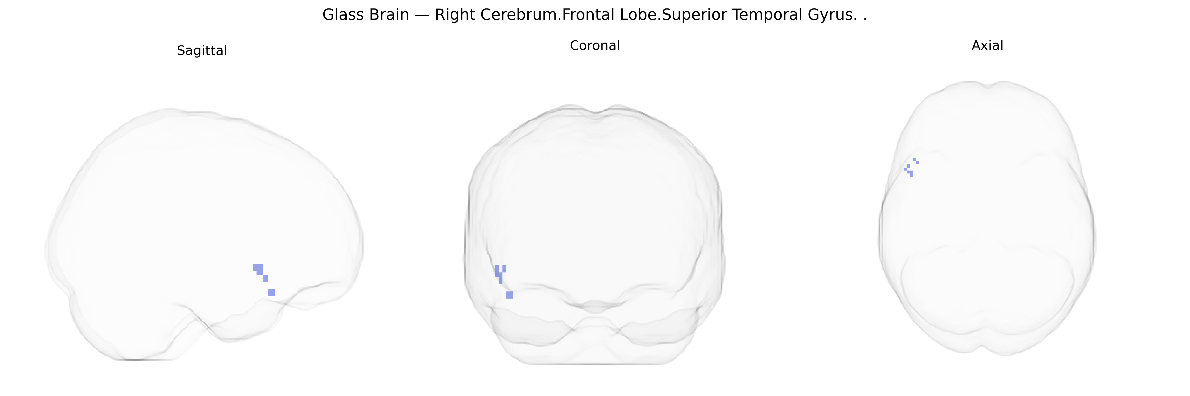 Triplanar Ghost Brain