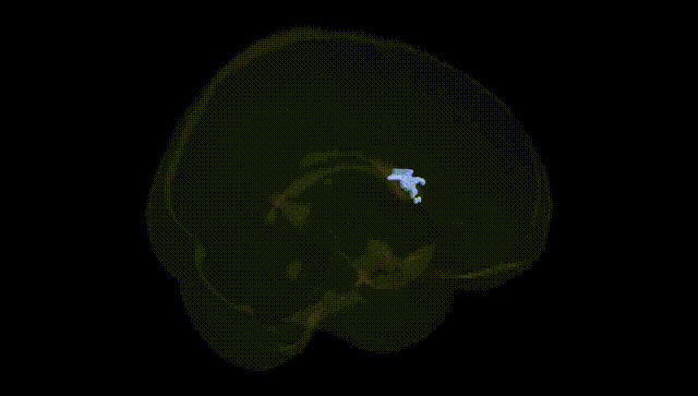 Full Brain Black