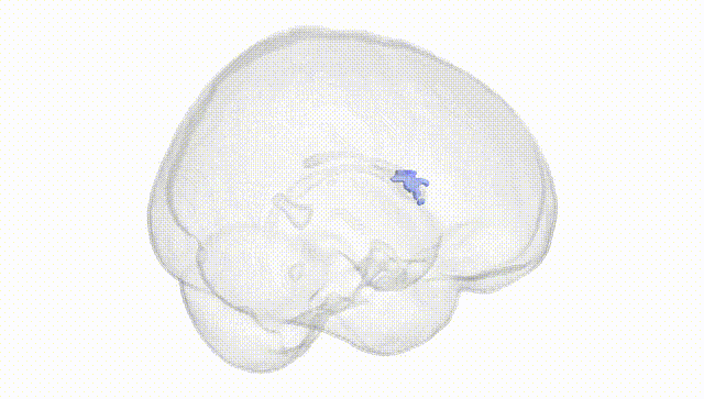 Full Brain White