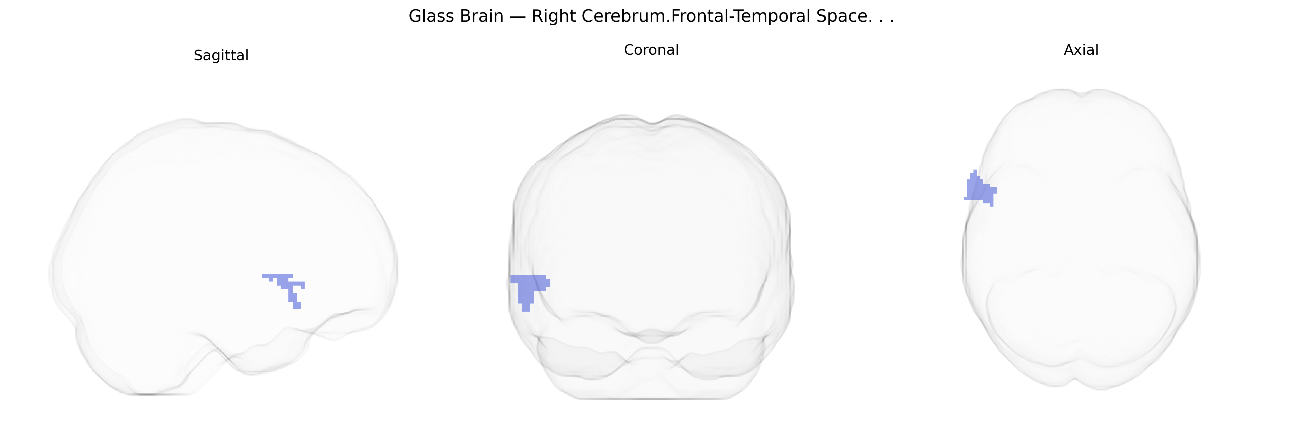 Triplanar Ghost Brain