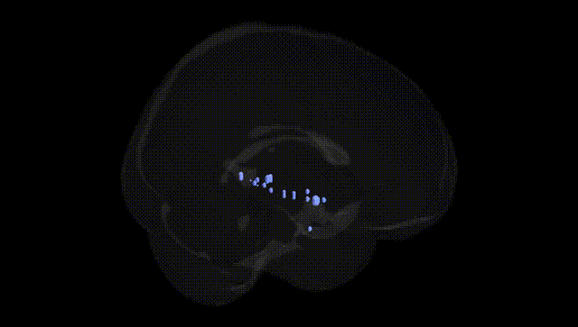 Full Brain Black