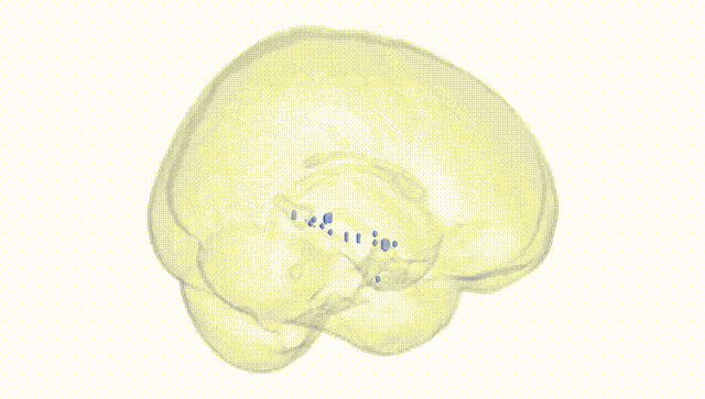 Full Brain White