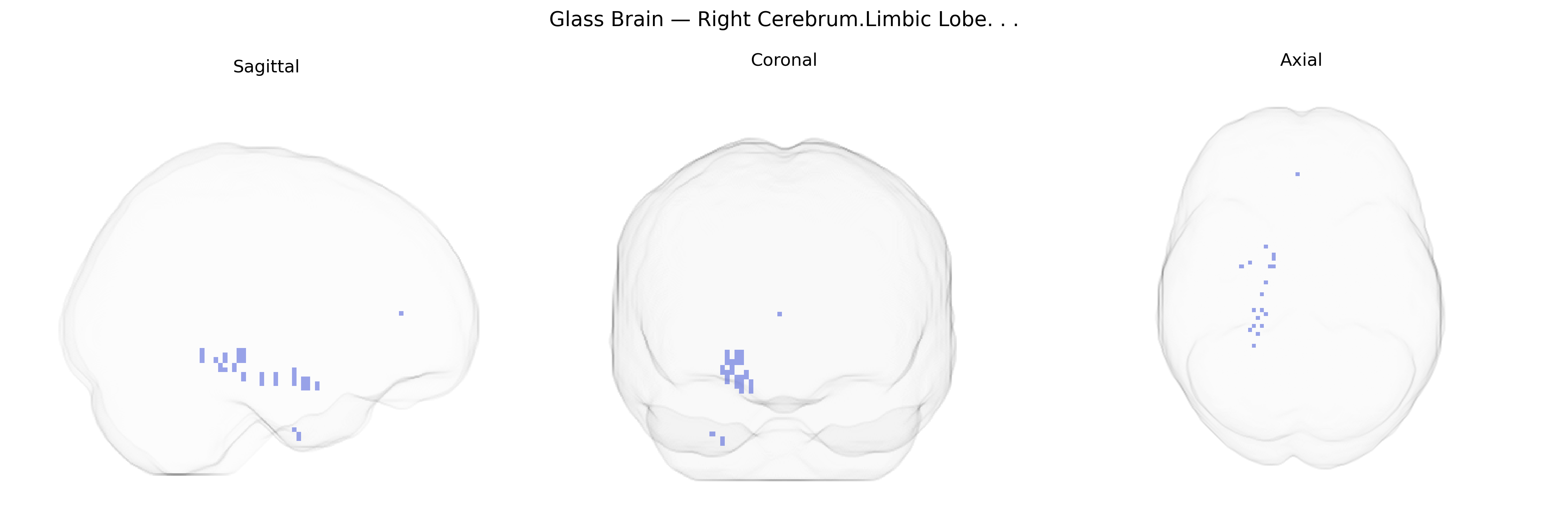 Triplanar Ghost Brain