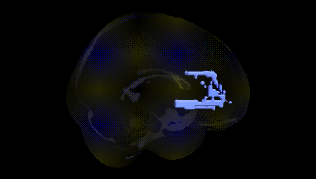 Full Brain Black