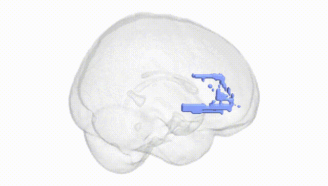 Full Brain White