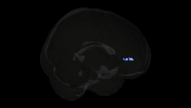 Full Brain Black
