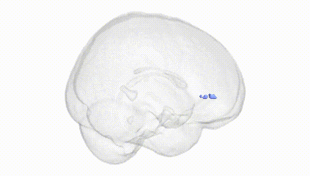 Full Brain White