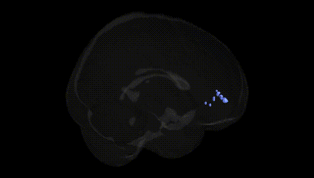 Full Brain Black