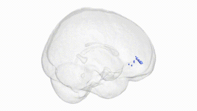 Full Brain White
