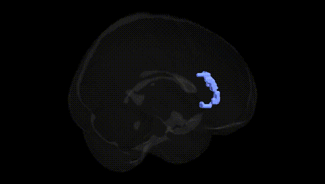 Full Brain Black