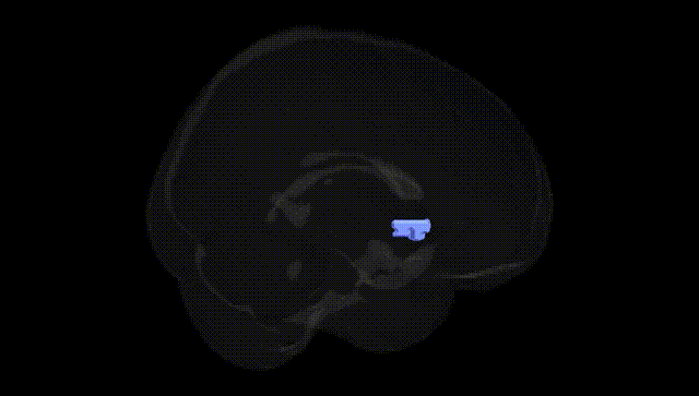 Full Brain Black