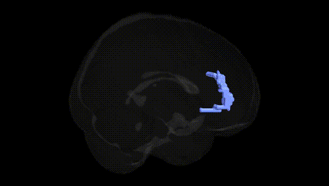 Full Brain Black