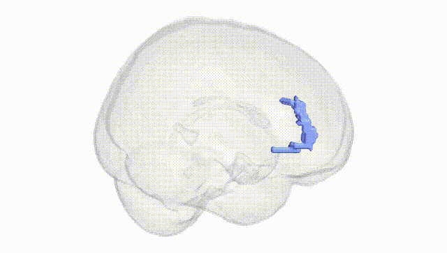 Full Brain White