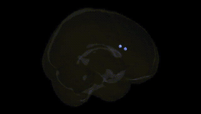 Full Brain Black
