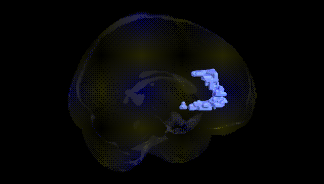 Full Brain Black