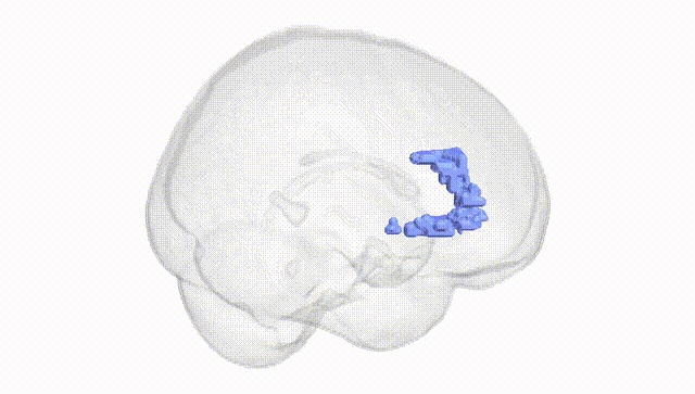 Full Brain White