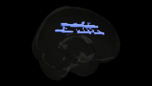Full Brain Black