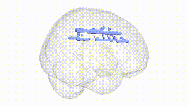 Full Brain White