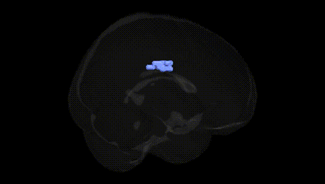 Full Brain Black