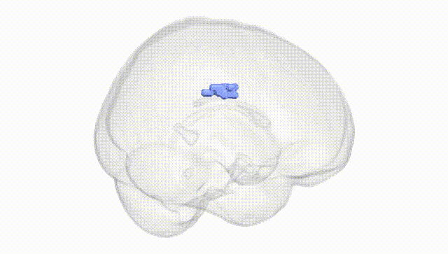 Full Brain White