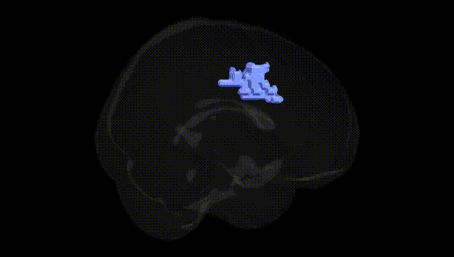 Full Brain Black