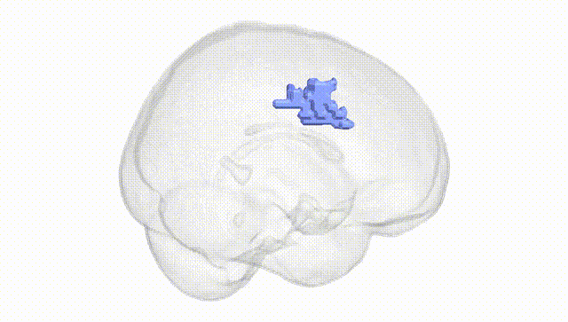 Full Brain White