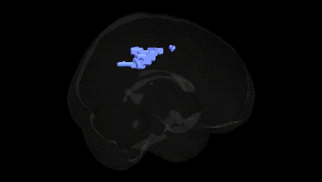 Full Brain Black