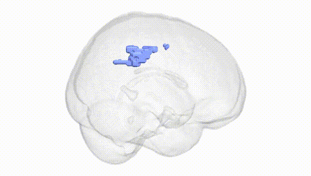 Full Brain White