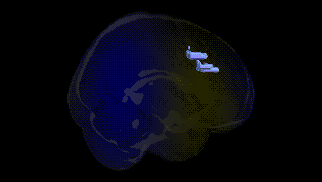 Full Brain Black