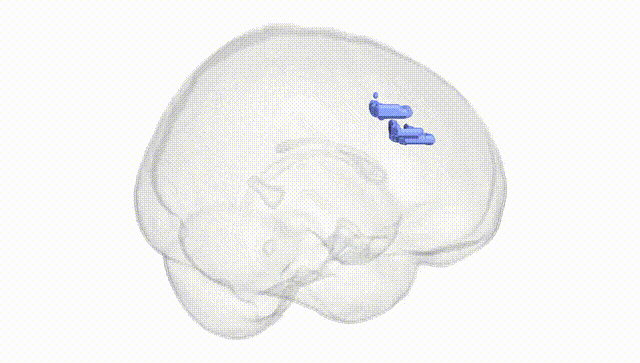 Full Brain White