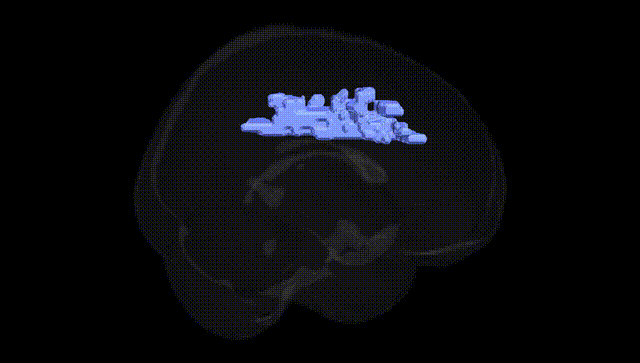 Full Brain Black
