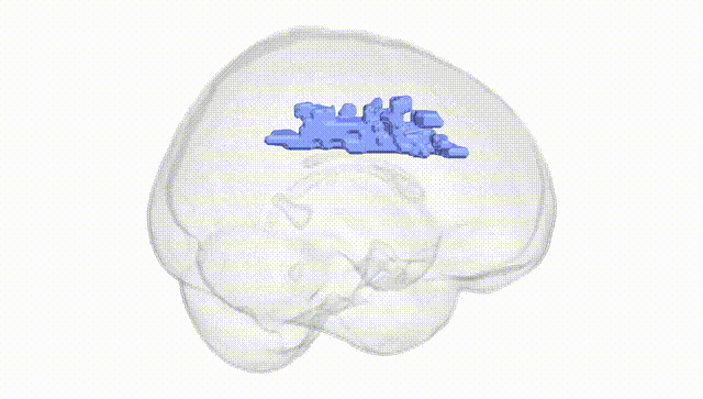 Full Brain White