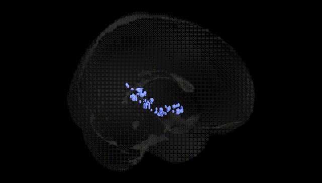 Full Brain Black