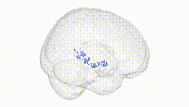 Full Brain White