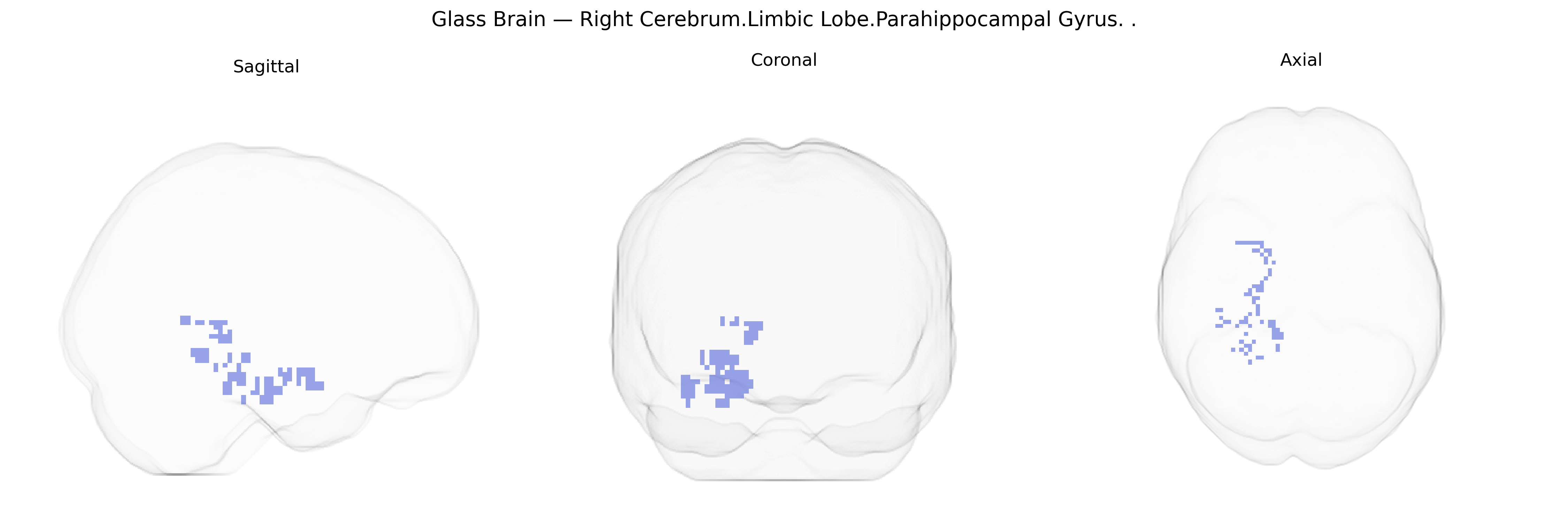Triplanar Ghost Brain