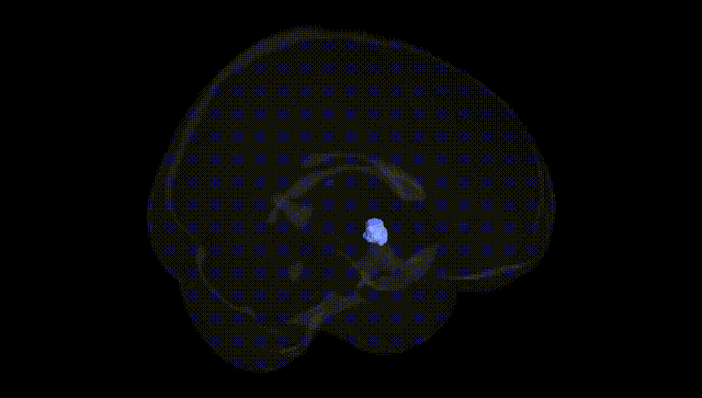 Full Brain Black