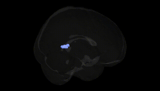 Full Brain Black