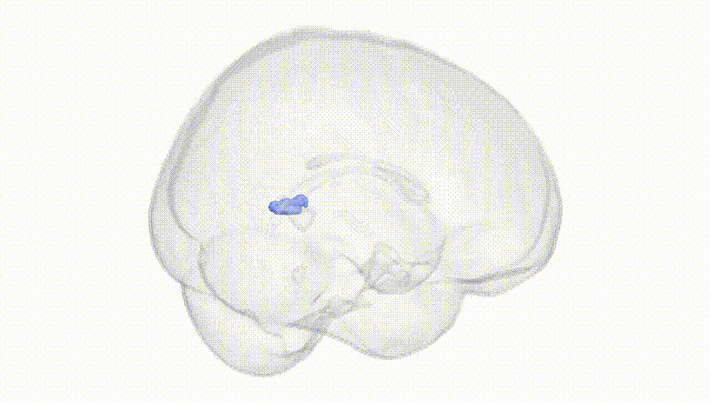 Full Brain White