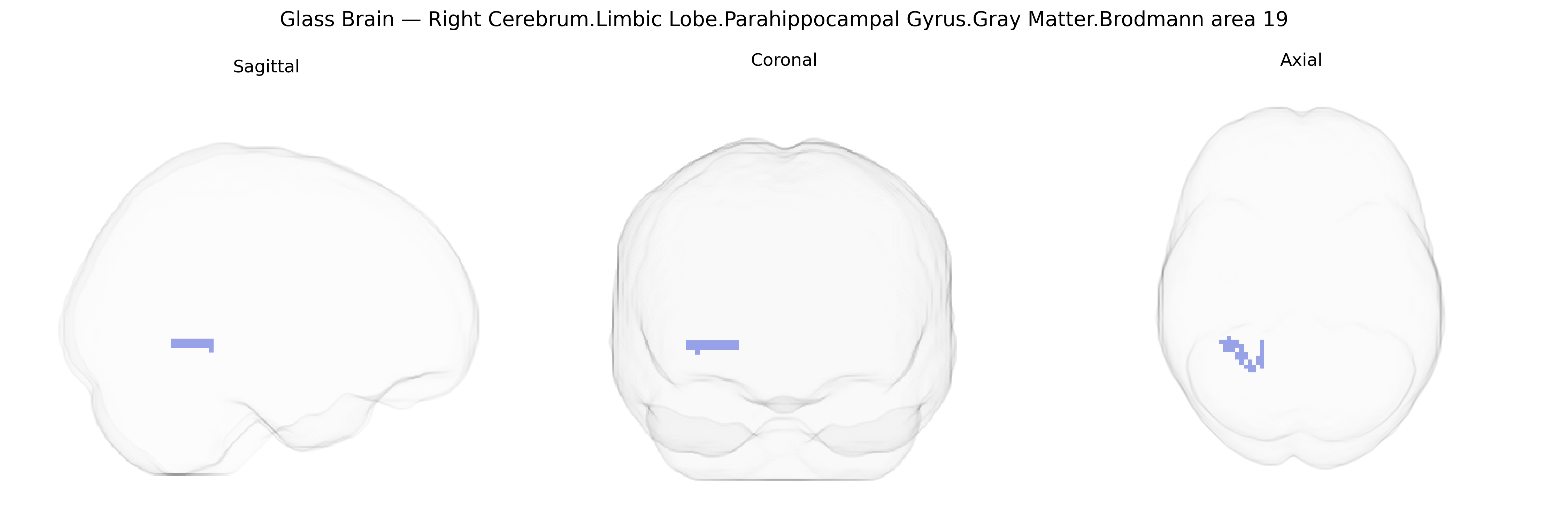 Triplanar Ghost Brain