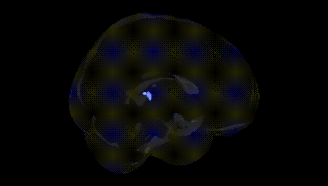 Full Brain Black