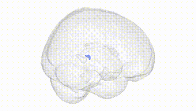 Full Brain White