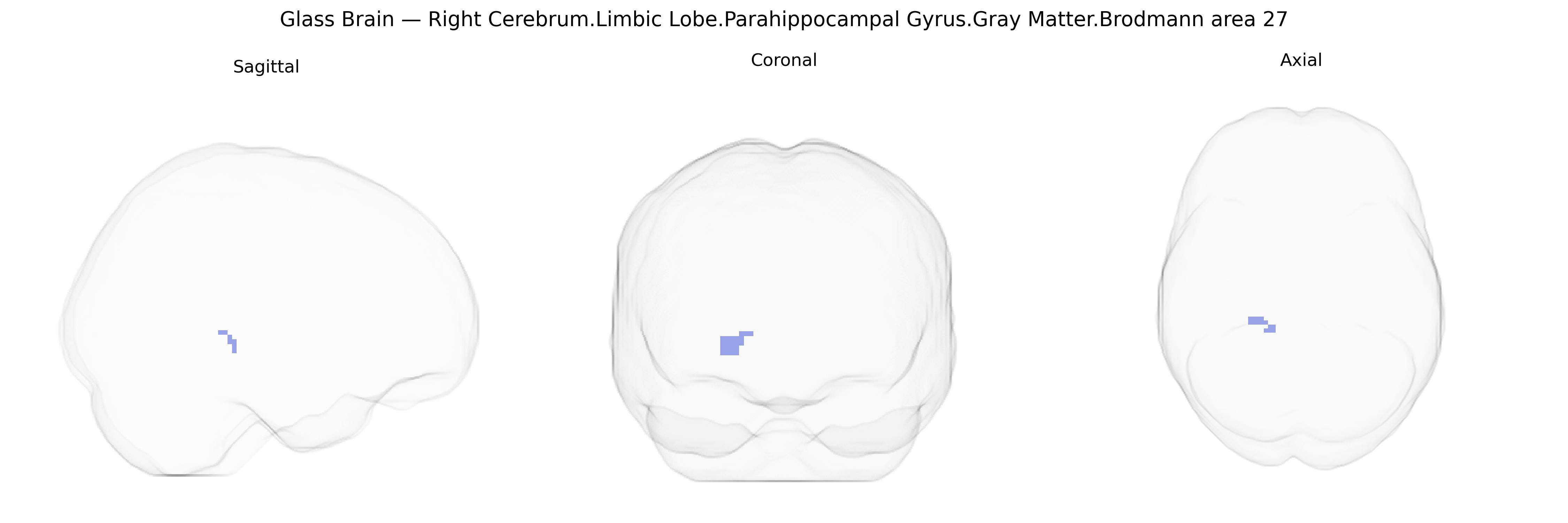 Triplanar Ghost Brain