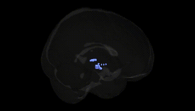 Full Brain Black