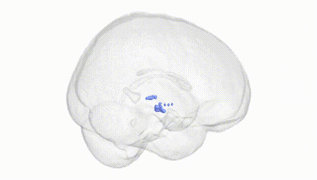 Full Brain White