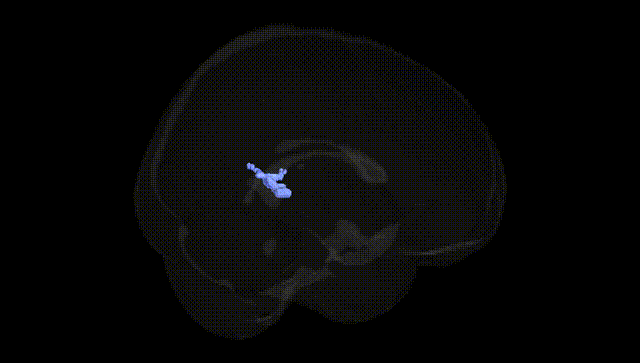 Full Brain Black