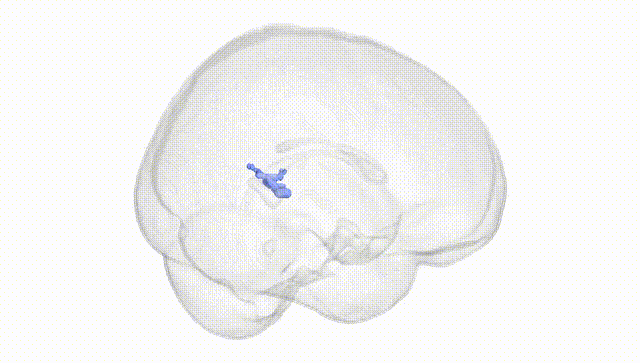 Full Brain White
