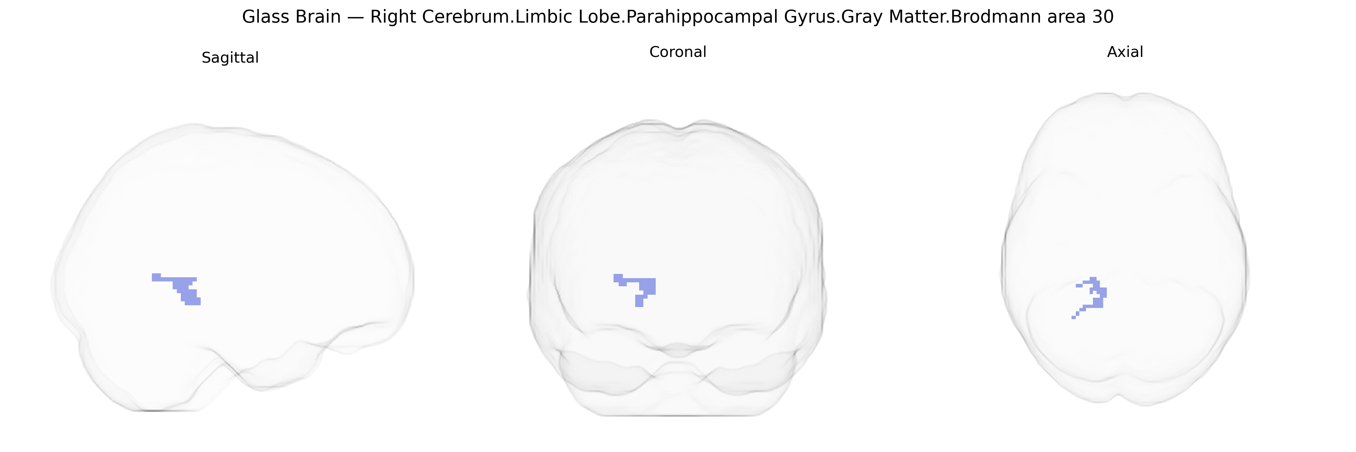 Triplanar Ghost Brain